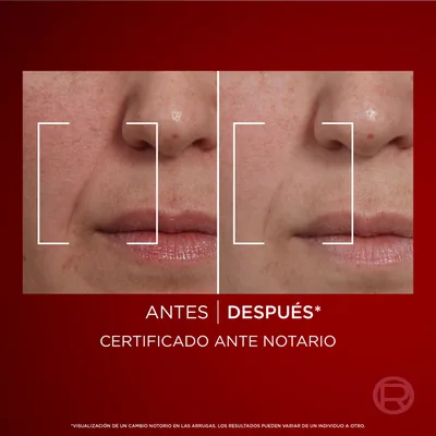 L'Oréal Paris Revitalift Laser Crema de Día Nº1 Anti-Edad Correctora 50 ml - 1 unidad – foto 9