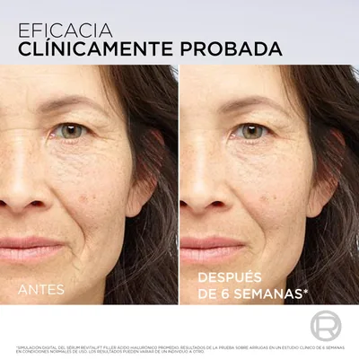 L'Oréal Paris Revitalift Filler Sérum Facial Ácido Hialurónico y PDRN 30 ml - 1 unidad – foto 4
