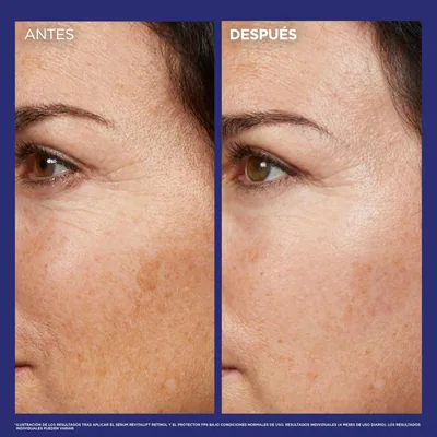 L'Oréal Paris Revitalift Laser Sérum de Noche Nº1 con Retinol Puro 30 ml - 1 unidad – foto 2