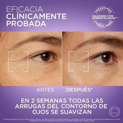L'Oréal Paris Revitalift Filler Sérum Ojos con Cafeína Antiarrugas 20 ml - 1 unidad – foto 4