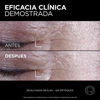 L'Oréal Paris Age Perfect Midnight Contorno de Ojos Reparador 15 ml - 1 unidad – foto 5