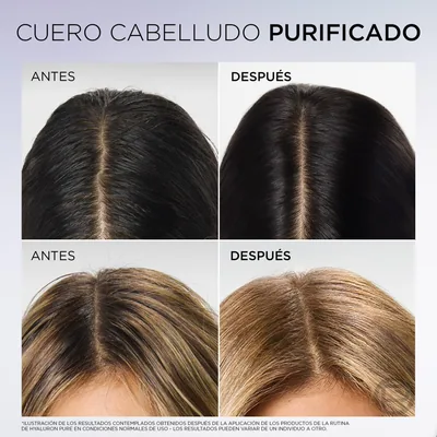 L'Oréal Paris Paris Elvive Champú Hialuronico Pure 380ml - pack de 3 unidades – foto 3