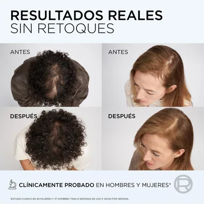 L'Oréal Paris Elvive Growth Booster Champú sin sulfatos Anticaída 200ml - pack de 3 unidades – foto 6