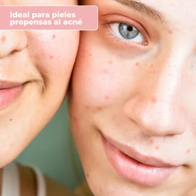Babaria Serum Facial Microbiota con Acido Hialuronico 30ml - pack de 2 unidades – foto 2